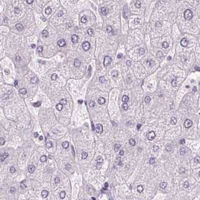 Immunohistochemistry-Paraffin: POMC Antibody [NBP2-55008]