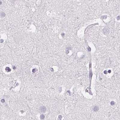 Immunohistochemistry-Paraffin: POMC Antibody [NBP2-57719]