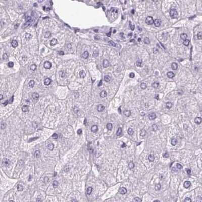 Immunohistochemistry-Paraffin: POMC Antibody [NBP2-57719]