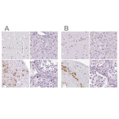 Immunohistochemistry-Paraffin: POMC Antibody [NBP2-57719]