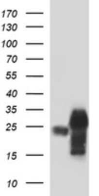 Western Blot: POMC Antibody (OTI2B2)Azide and BSA Free [NBP2-73525]