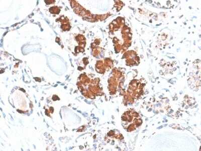 Immunohistochemistry-Paraffin: ACTH Antibody (rCLIP/1407) - Azide and BSA Free [NBP3-08617]