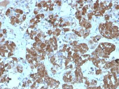 Immunohistochemistry-Paraffin: ACTH Antibody (rCLIP/1407) - Azide and BSA Free [NBP3-08617]