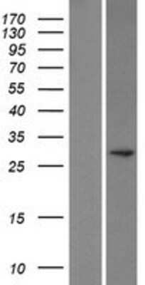 Western Blot: POMC Overexpression Lysate [NBL1-14599]