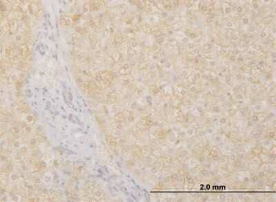 Immunohistochemistry-Paraffin: POMGNT1 Antibody (6C12) [H00055624-M07]