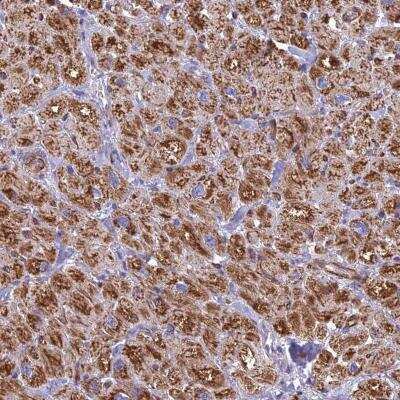 Immunohistochemistry-Paraffin: POMGNT1 Antibody [NBP1-82193]