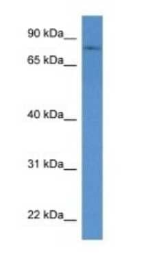 Western Blot: POMGNT1 Antibody [NBP1-74108]