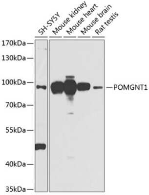 Western Blot: POMGNT1 AntibodyBSA Free [NBP2-93561]