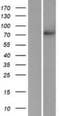 Western Blot: POMGNT1 Overexpression Lysate [NBP2-06933]