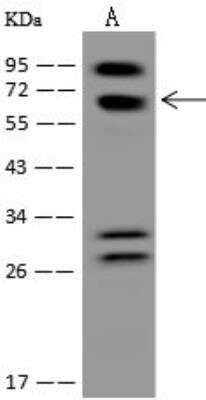 Western Blot: POMGNT2 Antibody [NBP3-12610]