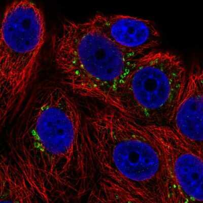 Immunocytochemistry/ Immunofluorescence: POMT1 Antibody [NBP2-57200]