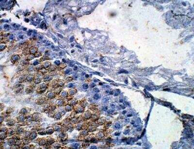 Immunohistochemistry-Paraffin: POMT1 Antibody [NBP3-12487]