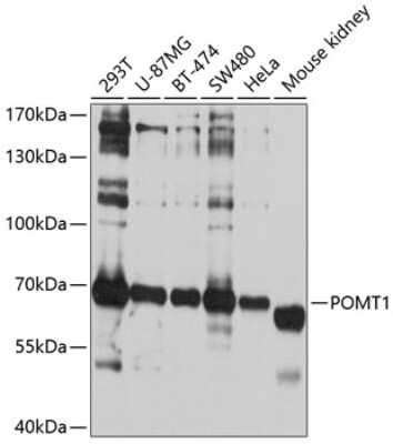 Western Blot: POMT1 AntibodyBSA Free [NBP2-93413]