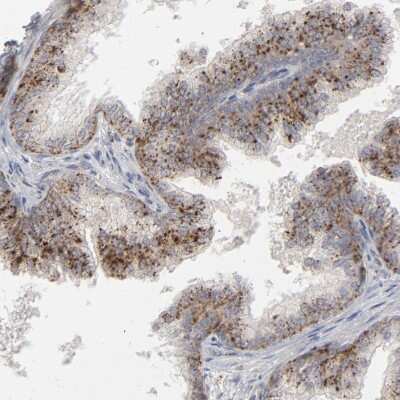 Immunohistochemistry-Paraffin: POMT2 Antibody [NBP1-86152]