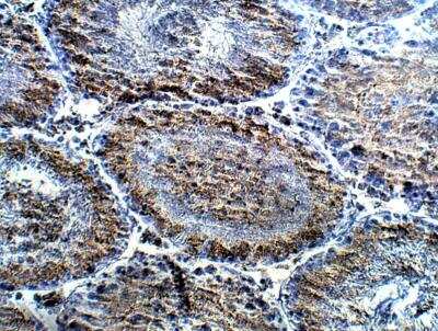 Immunohistochemistry-Paraffin: POMT2 Antibody [NBP3-12334]