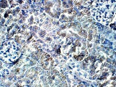 Immunohistochemistry-Paraffin: POMT2 Antibody [NBP3-12334]