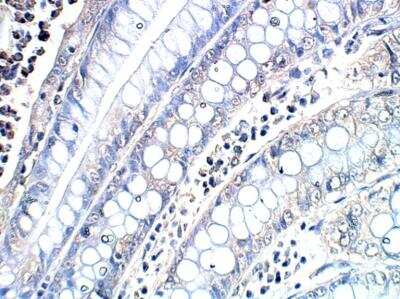 Immunohistochemistry-Paraffin: POMT2 Antibody [NBP3-12334]