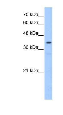 Western Blot: POMT2 Antibody [NBP1-60068]