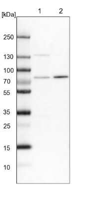 Western Blot: POMT2 Antibody [NBP1-86152]