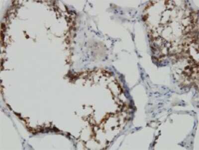 Immunohistochemistry-Paraffin: POMZP3 Antibody (2E7) [H00022932-M02]