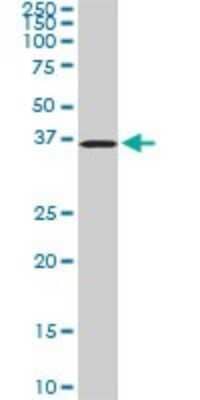 Western Blot: POMZP3 Antibody (2E7) [H00022932-M02]