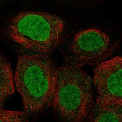 Immunocytochemistry/ Immunofluorescence: POM121 Antibody [NBP2-13788]