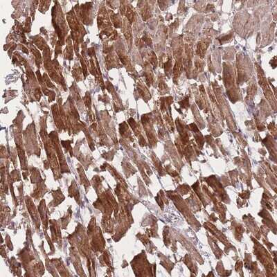 Immunohistochemistry-Paraffin: POM121 Antibody [NBP2-13788]