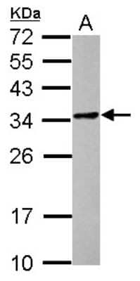 Western Blot: POMZP3 Antibody [NBP2-19892]