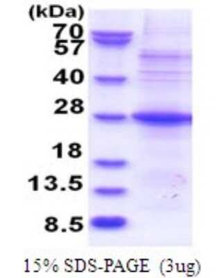 SDS-PAGE: Recombinant Human POMZP3 His Protein [NBP2-51772]