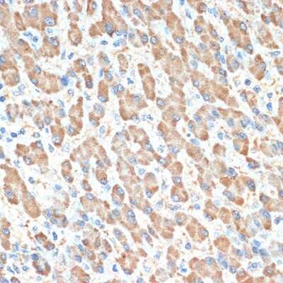 Immunohistochemistry-Paraffin: PON1 Antibody (4X7X2) [NBP3-16187]