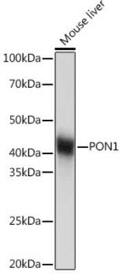 Western Blot: PON1 Antibody (4X7X2) [NBP3-16187]