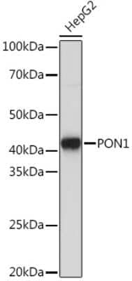 Western Blot: PON1 Antibody (4X7X2) [NBP3-16187]