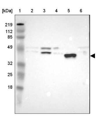 Western Blot: PON1 Antibody [NBP1-84791]