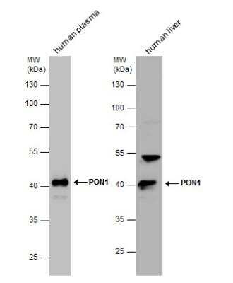 Western Blot: PON1 Antibody [NBP2-19893]