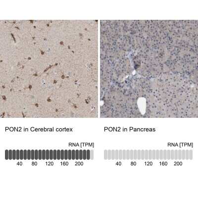 Immunohistochemistry-Paraffin: PON2 Antibody [NBP1-86365]