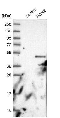 Western Blot: PON2 Antibody [NBP1-86365]