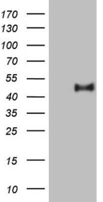 Western Blot: PON3 Antibody (OTI5C3) [NBP2-45370]