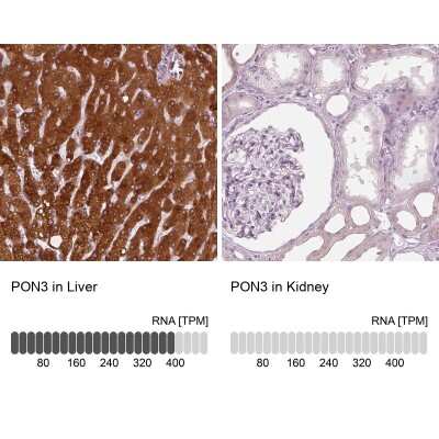 Immunohistochemistry-Paraffin: PON3 Antibody [NBP1-86074]