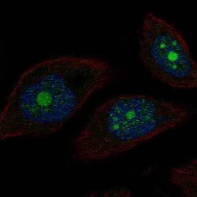 Immunocytochemistry/ Immunofluorescence: POP1 Antibody [NBP2-68837]