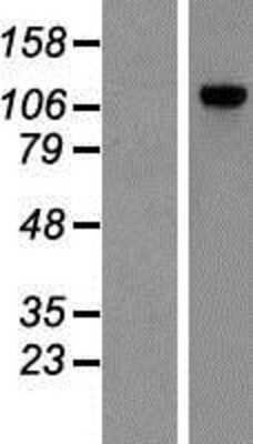 Western Blot: POP1 Overexpression Lysate [NBP2-07222]