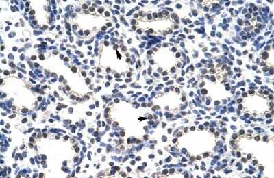 Immunohistochemistry-Paraffin: POP4 Antibody [NBP1-57218]