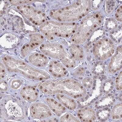 Immunohistochemistry-Paraffin: POP4 Antibody [NBP1-92281]
