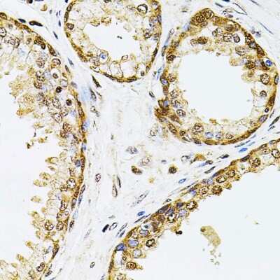 Immunohistochemistry-Paraffin: POP4 Antibody - BSA Free [NBP2-93109]