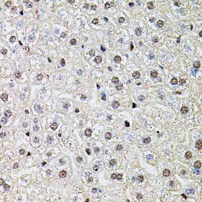 Immunohistochemistry-Paraffin: POP4 Antibody - BSA Free [NBP2-93109]