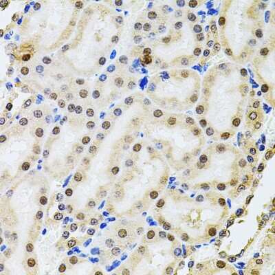 Immunohistochemistry-Paraffin: POP4 Antibody - BSA Free [NBP2-93109]