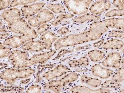 Immunohistochemistry-Paraffin: POP4 Antibody [NBP2-98016]