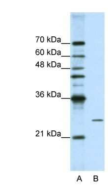 Western Blot: POP4 Antibody [NBP1-57218]