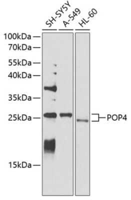 Western Blot: POP4 AntibodyBSA Free [NBP2-93109]