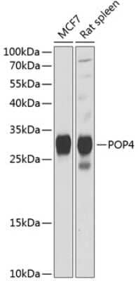 Western Blot: POP4 AntibodyBSA Free [NBP2-95131]