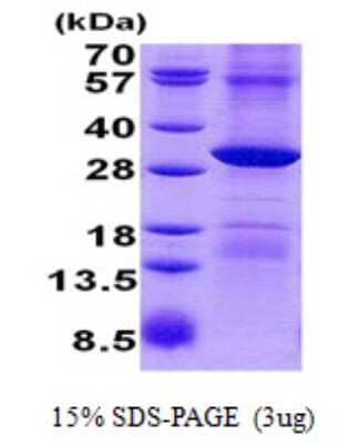 SDS-PAGE: Recombinant Human POP4 His Protein [NBP2-23362]